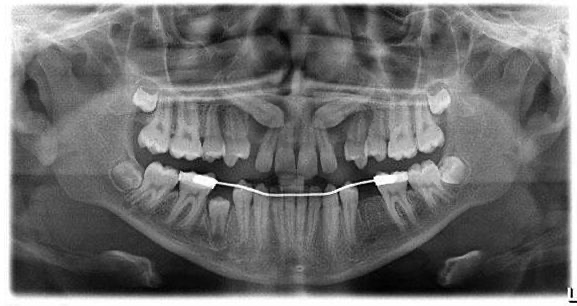Lsu Oral and Maxillofacial Surgery Faculty Practice - Baton Rouge photo 4