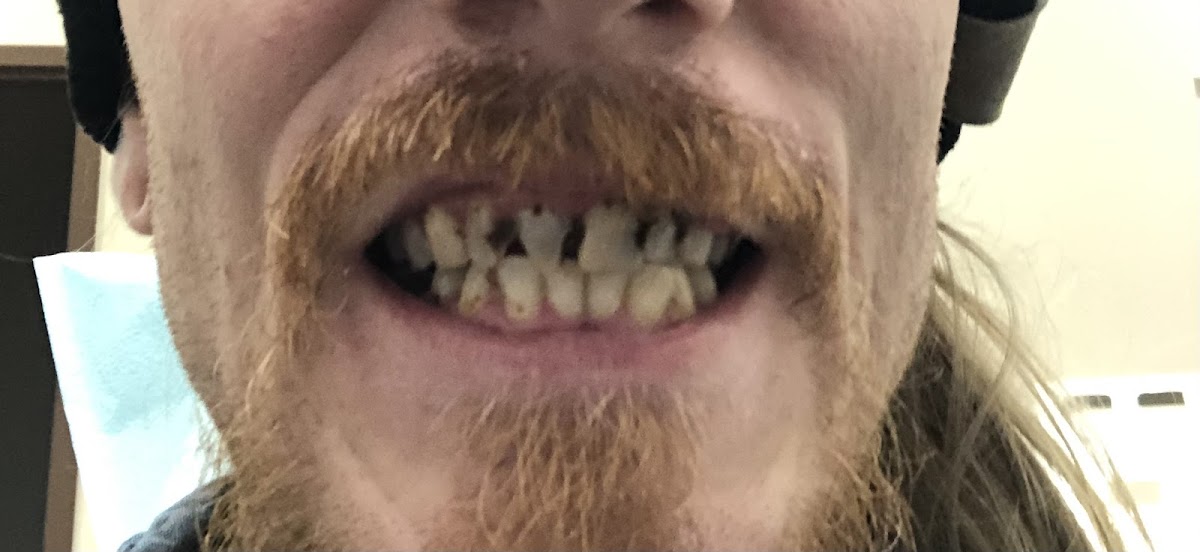 Fredericksburg Dental Artists photo 6