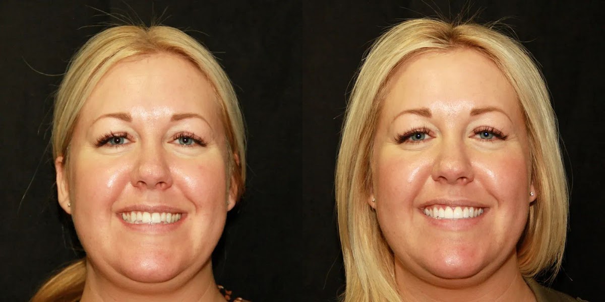 Intermountain Smiles photo 5