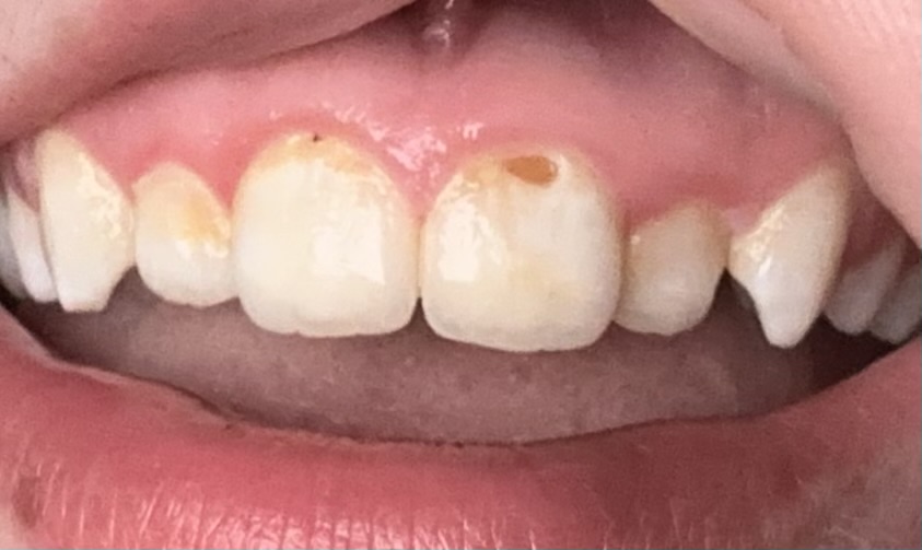 Aspen Dental - Rocky Mount photo 2