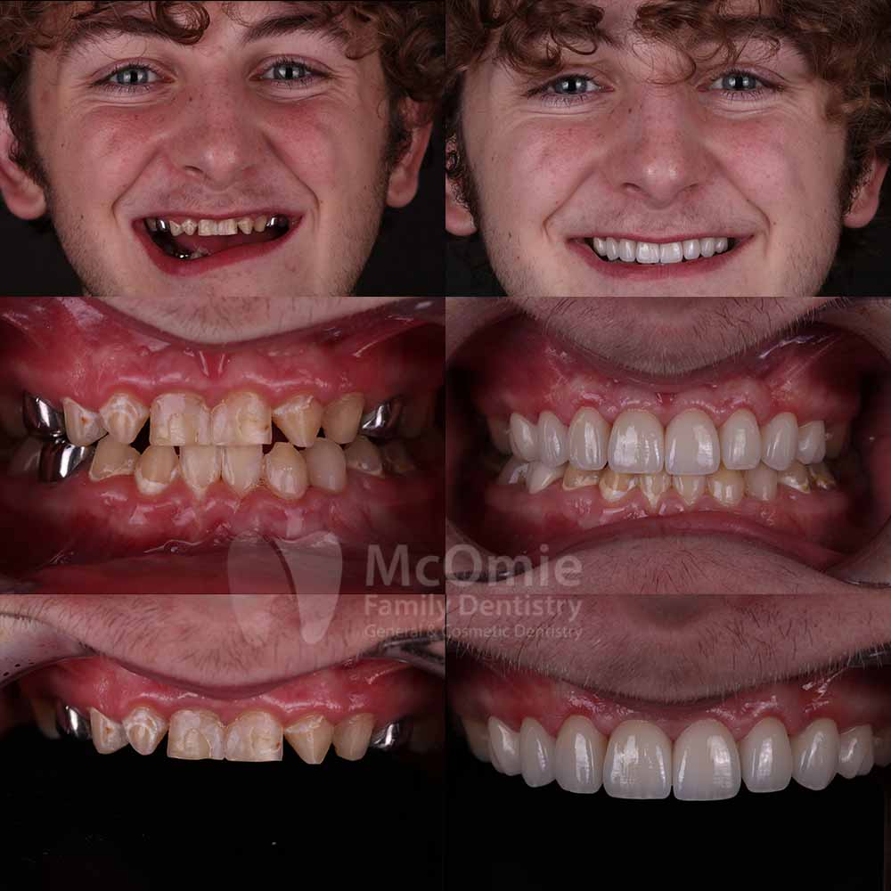 Mcomie Dentistry Chattanooga photo 2