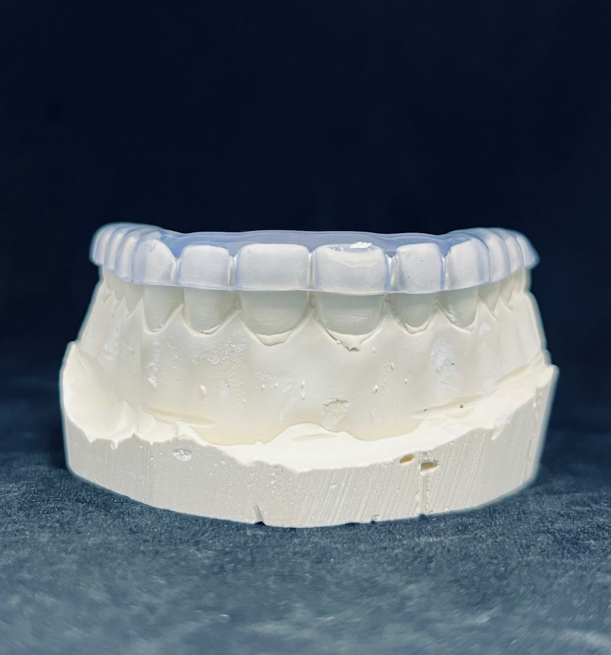 The Denture Place - Implant, General and Cosmetic Dentistry photo 3