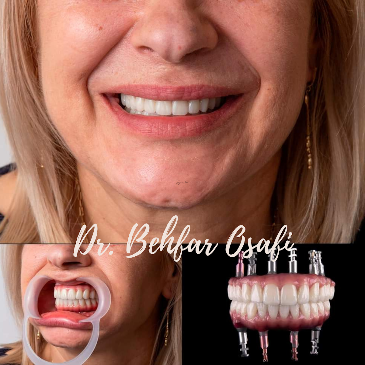 New Life Dental Implant Center photo 1