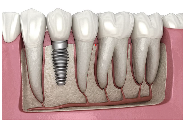Soulard Family Dentistry - St. Louis, Mo photo 5