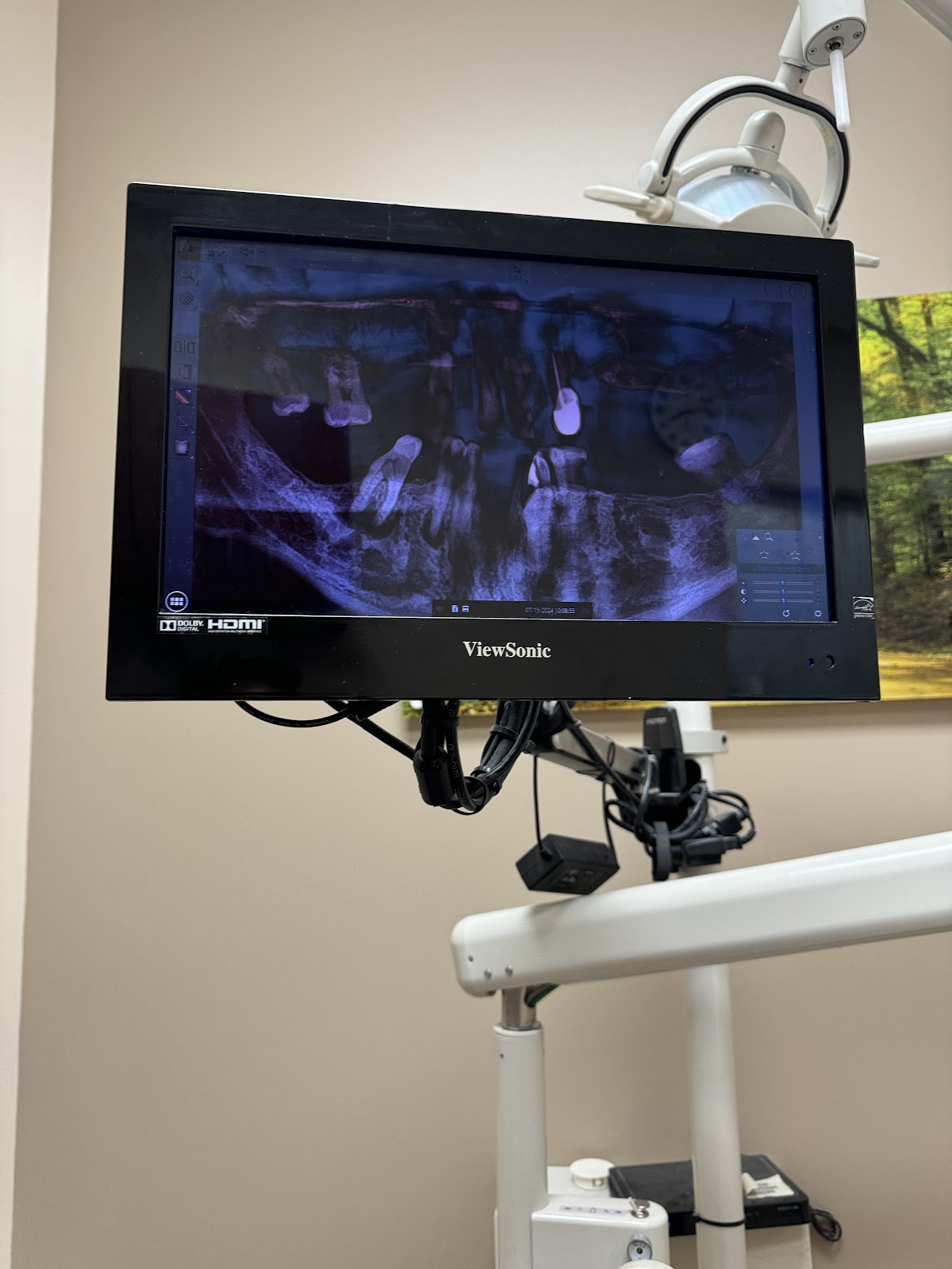 Aspen Dental - Cartersville photo 3