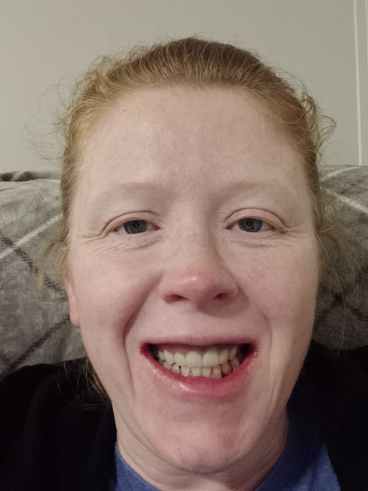 Affordable Dentures & Implants - Overland Park photo 5