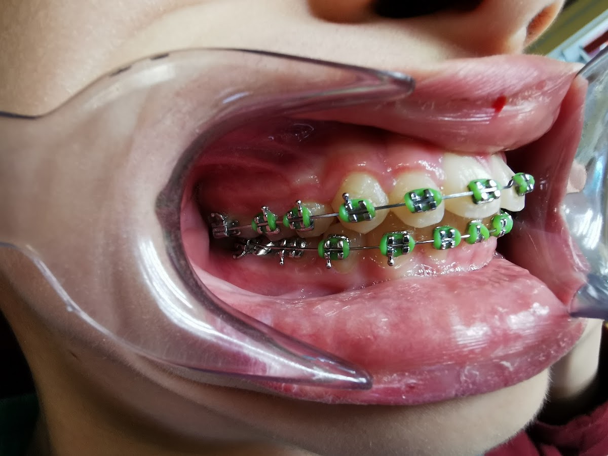 Confluence Dental Wenatchee photo 5