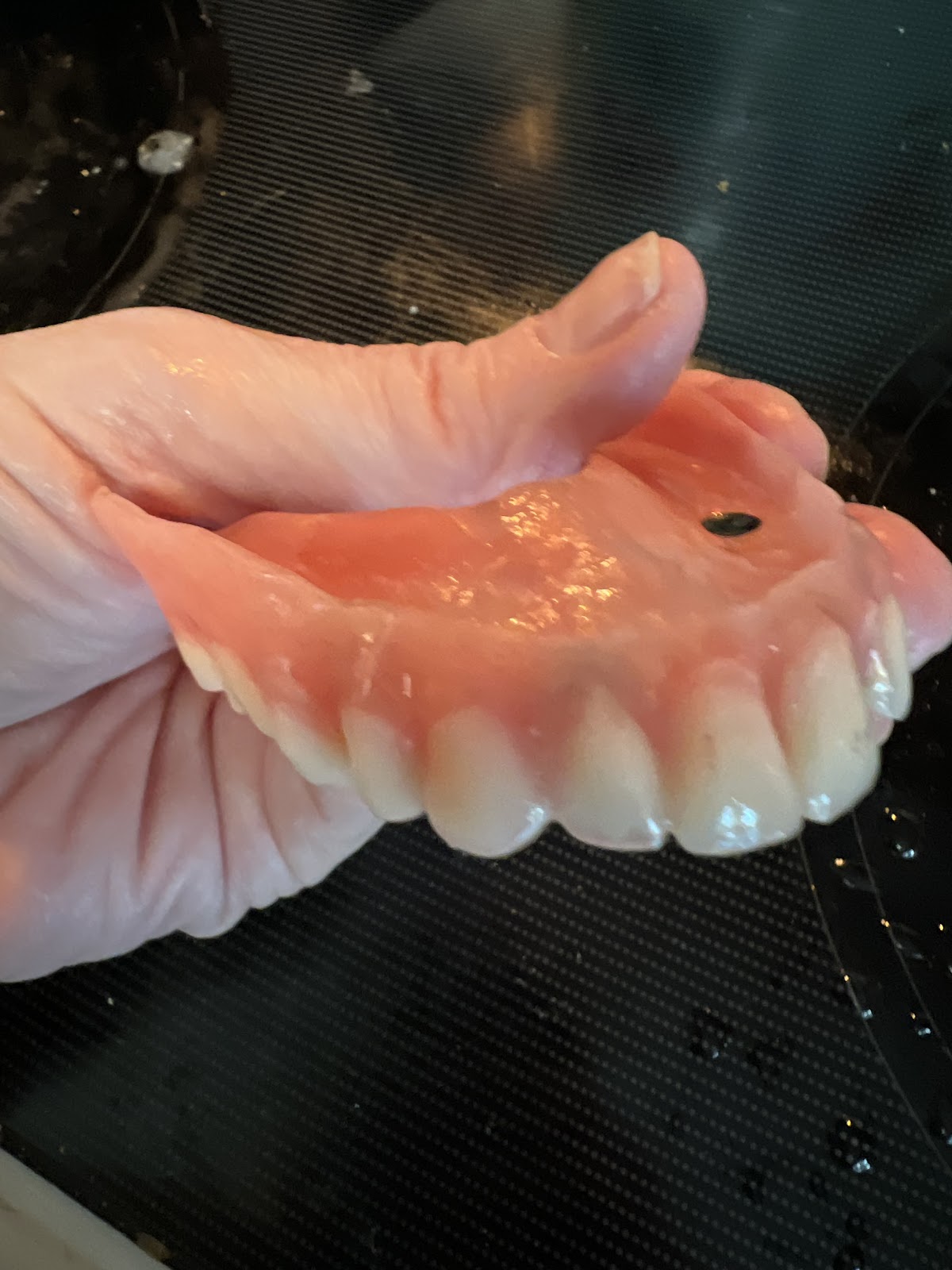 Affordable Dentures & Implants - Flowood photo 2