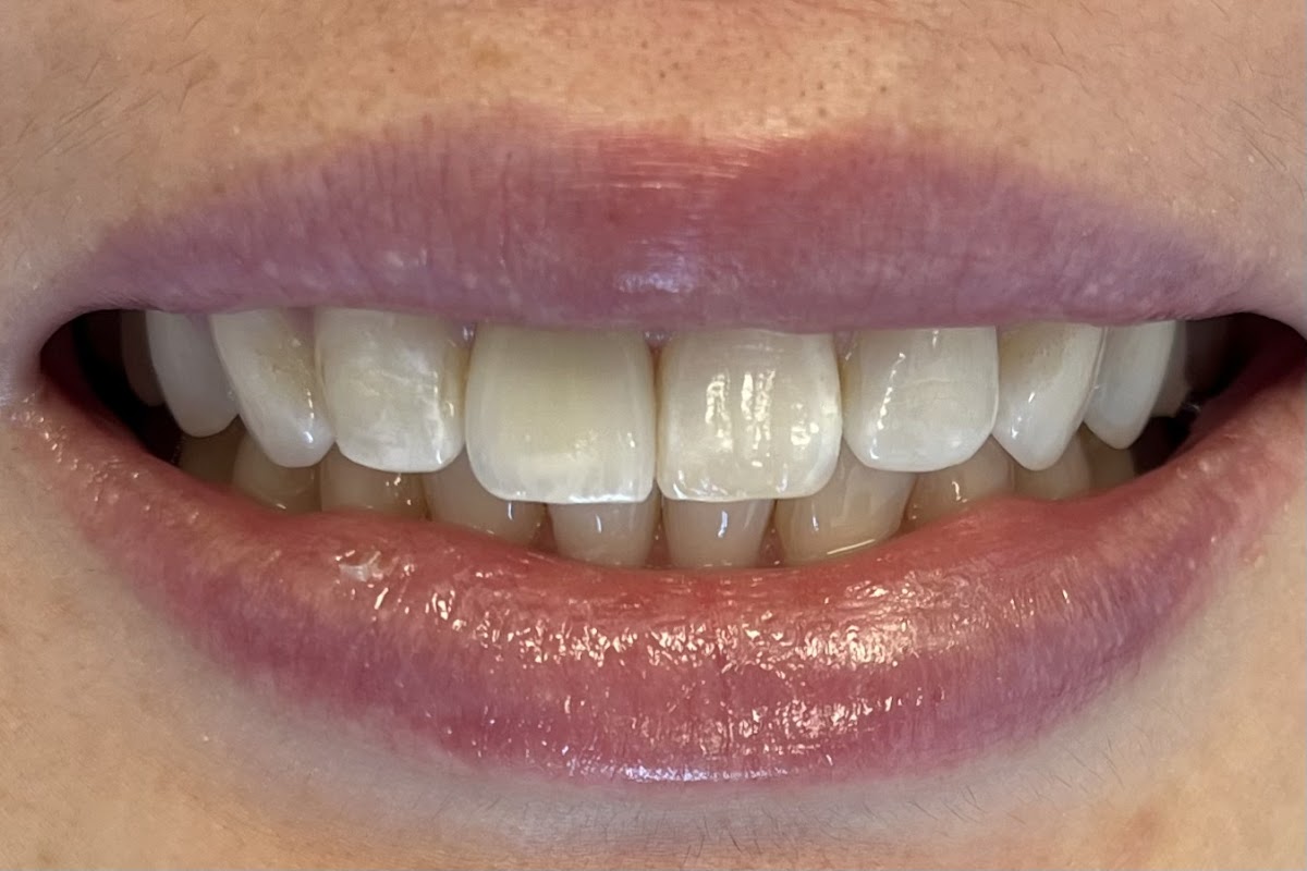 Smilehouse Dental photo 4