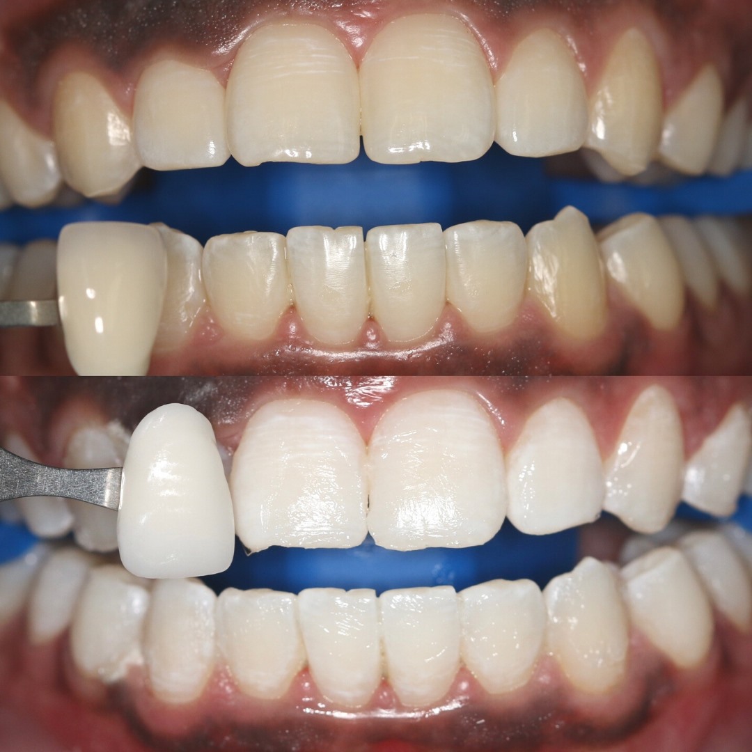 Koch Aesthetic Dentistry - the Dental Spa photo 4