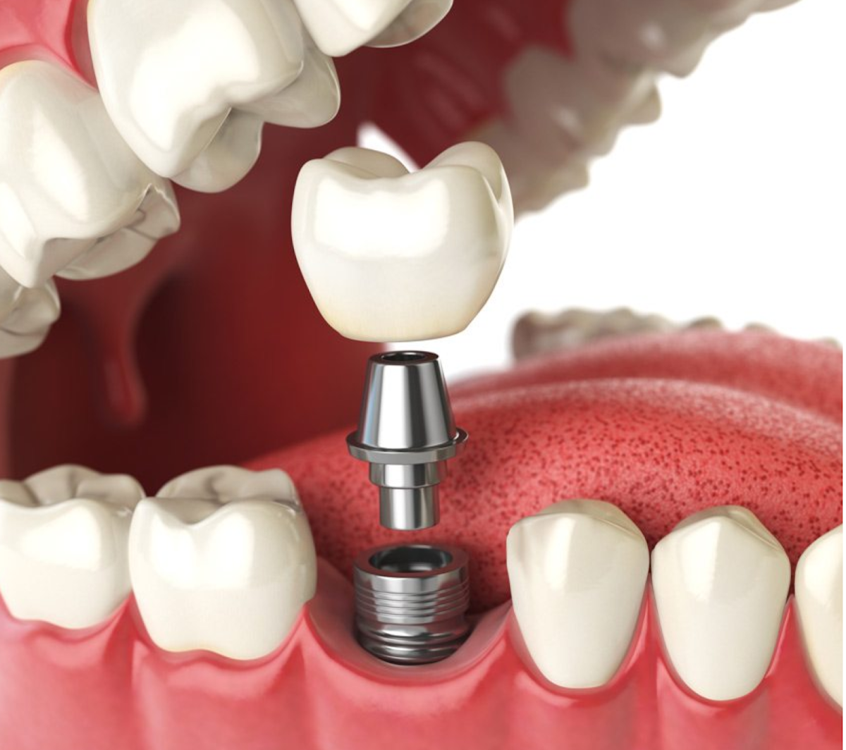 Cascade Oral & Facial Surgery photo 5