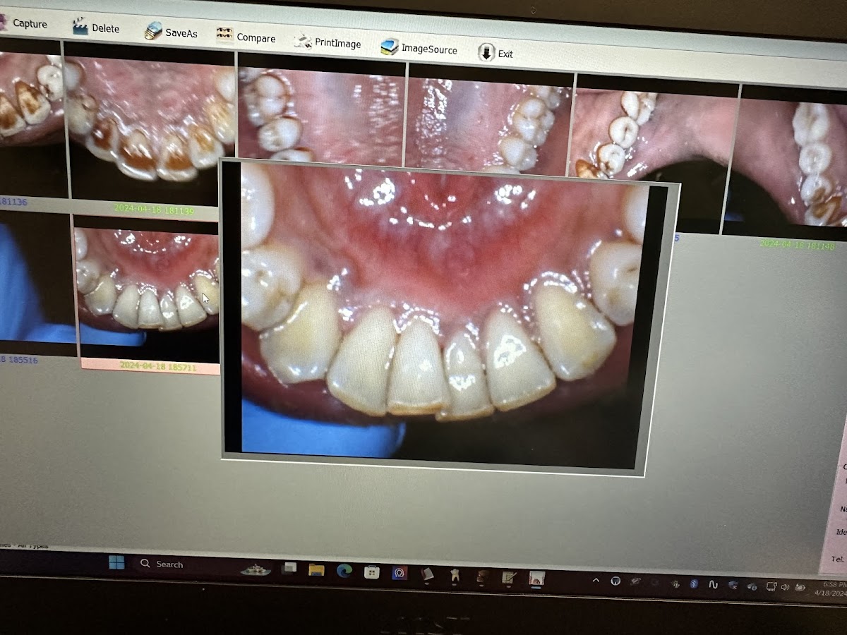Av Dental Associates photo 6