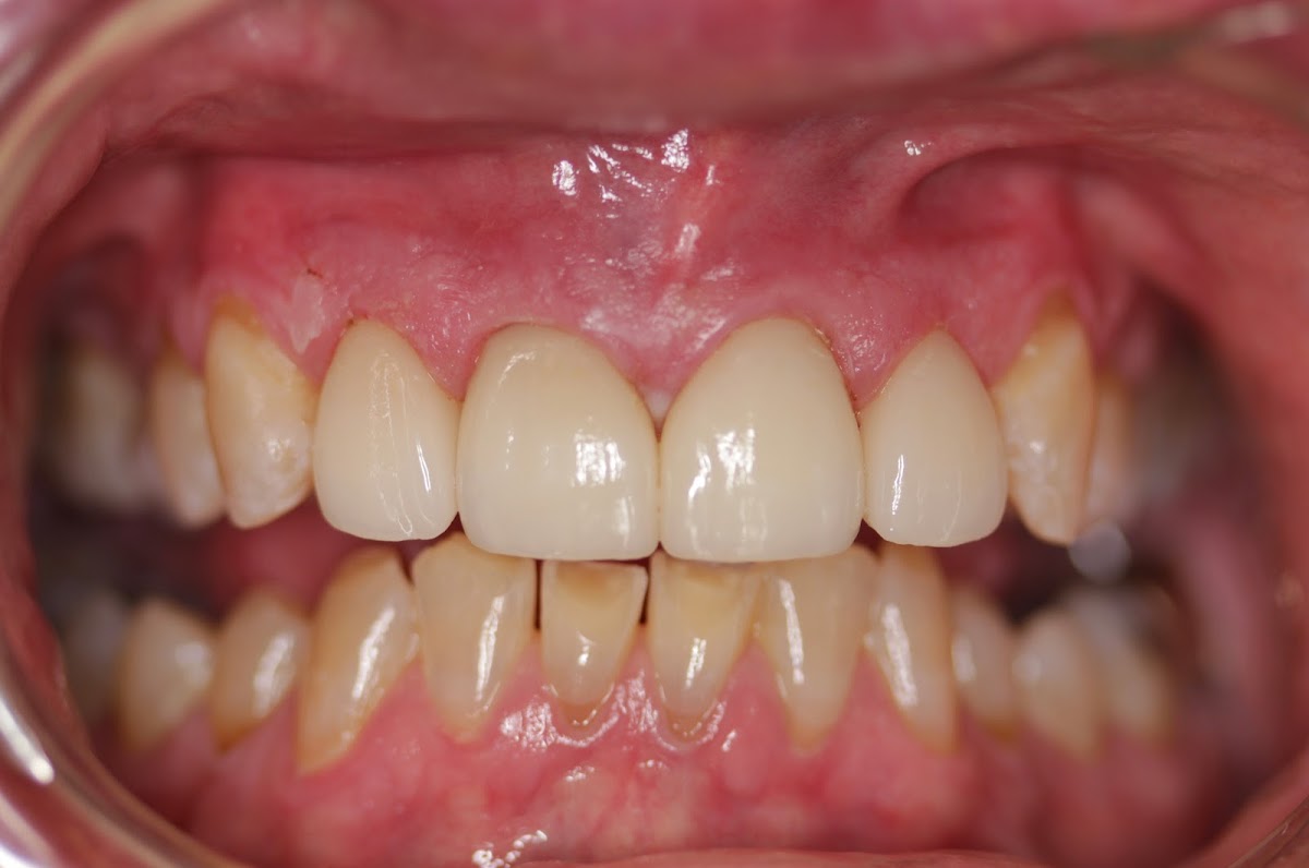 Idaho Falls Smiles Justin G Frandsen DDS and Brandon S. Griffin DMD photo 5