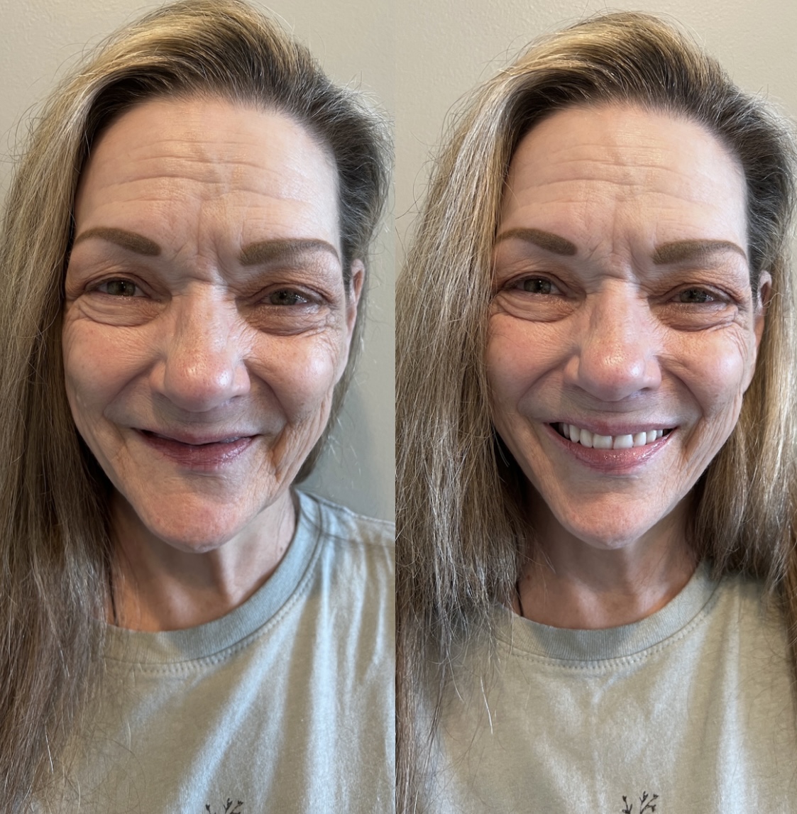 Gentle Family Dentistry Center for Implants & Facial Aesthetics photo 6