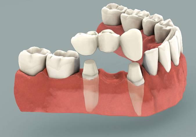 Baker Ranch Dental Spa & Implant Center photo 5