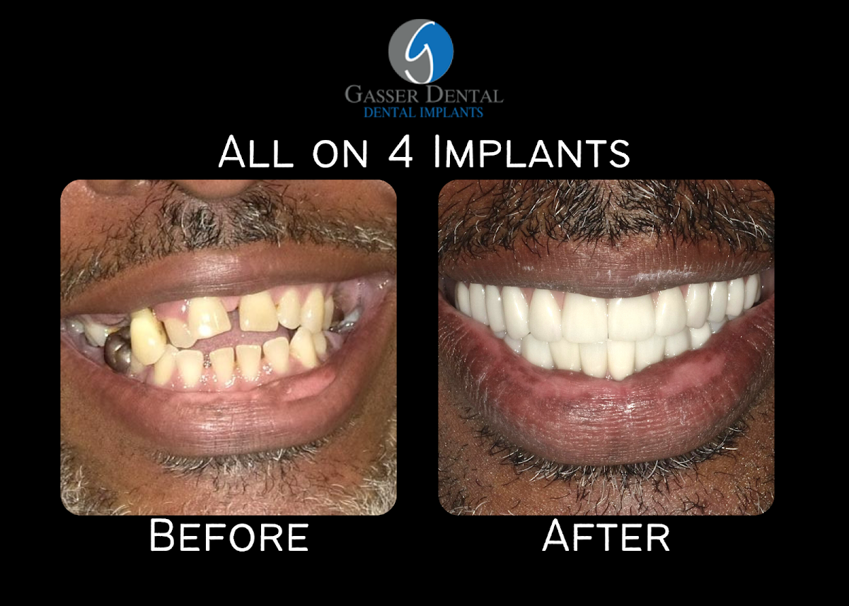 Gasser Dental Implants photo 3