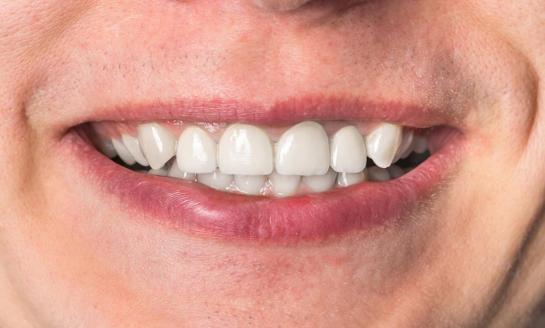 Grant Heller, DDS photo 3