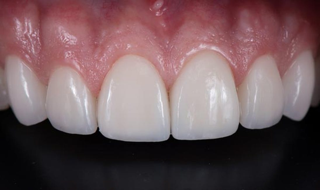 Grant Heller, DDS photo 5