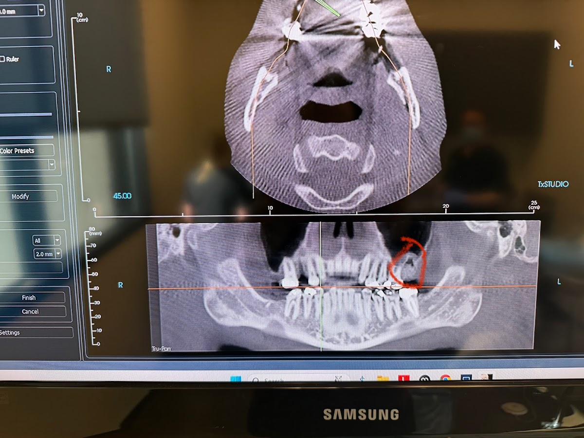 Canyon Point Implant & Oral Surgery photo 2