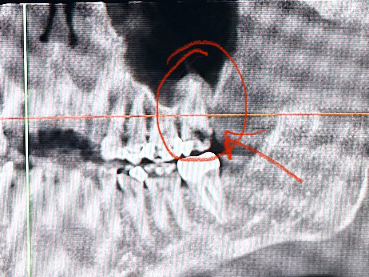 Canyon Point Implant & Oral Surgery photo 4