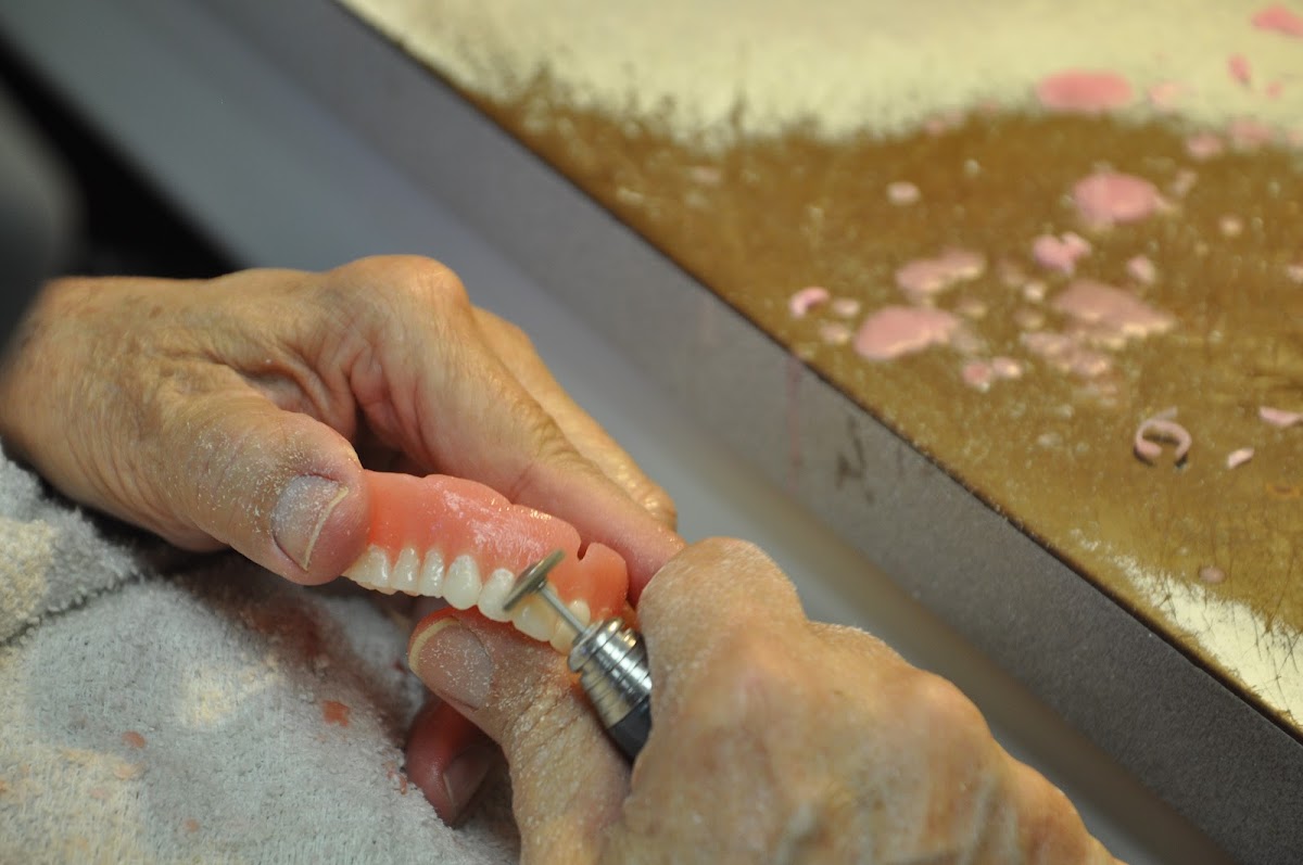 Denture Designs photo 4