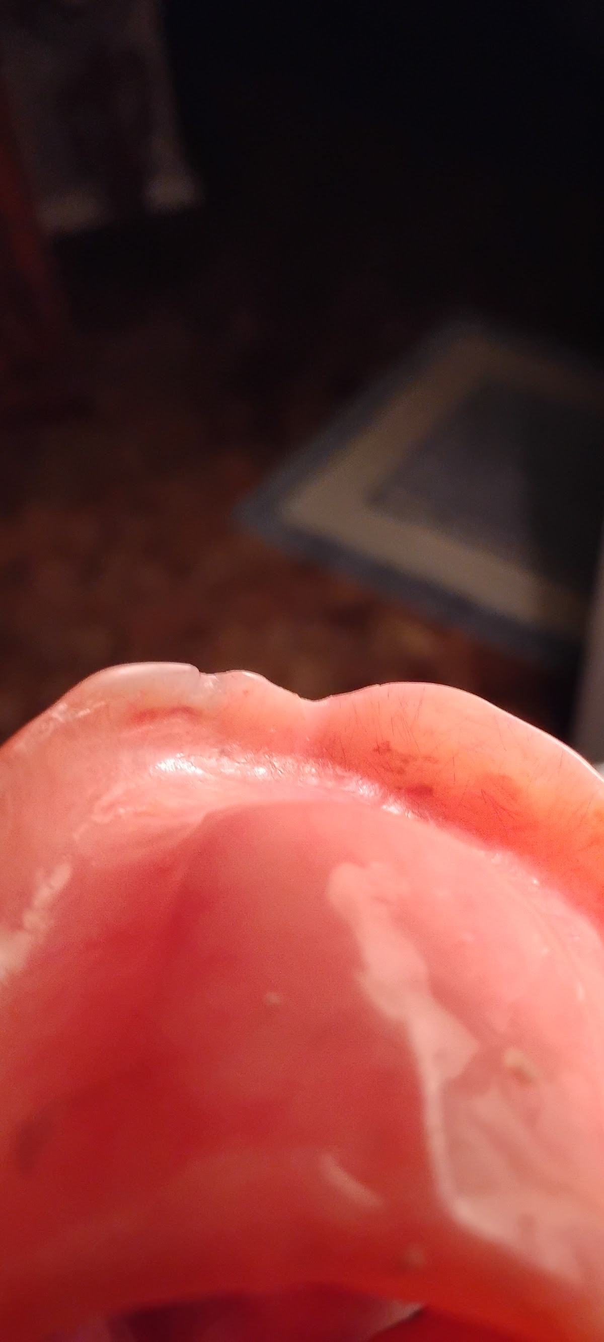 Aspen Dental - West Burlington photo 3