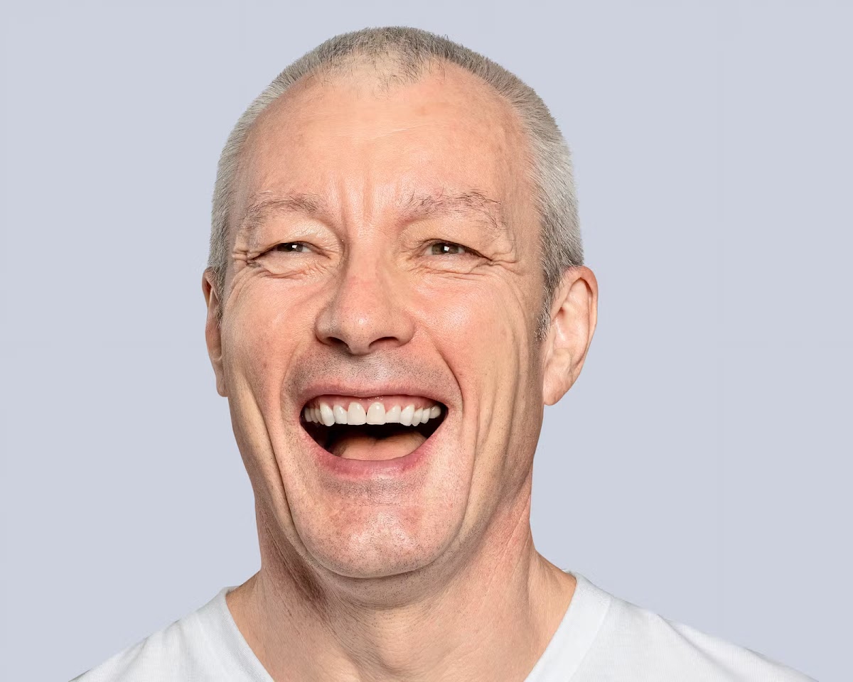 Dental Implants Palm Beach Gardens photo 5