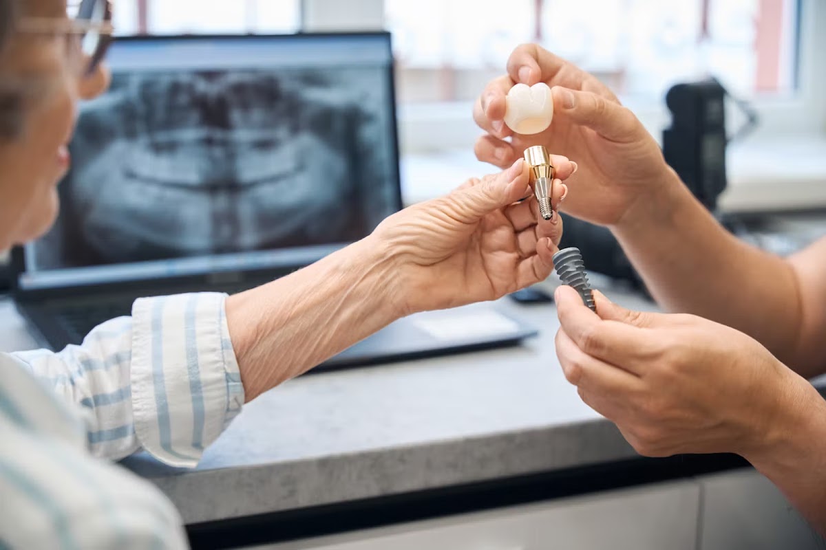 Dental Implants Palm Beach Gardens photo 6