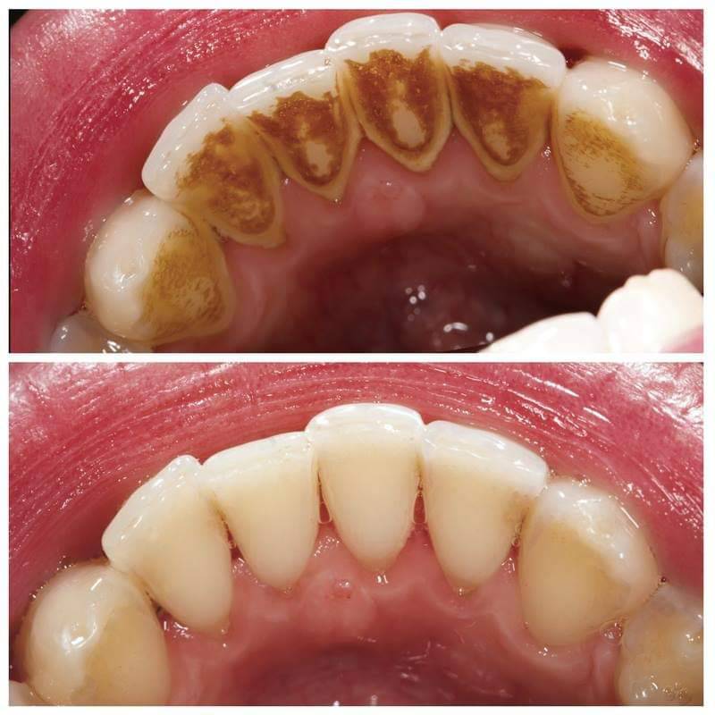 Dr. Michael J Stiles DDS - Westminster Dental Arts photo 2