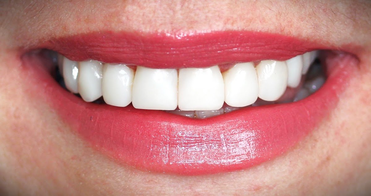 Bg Dental Wellness and Cosmetic Center photo 2