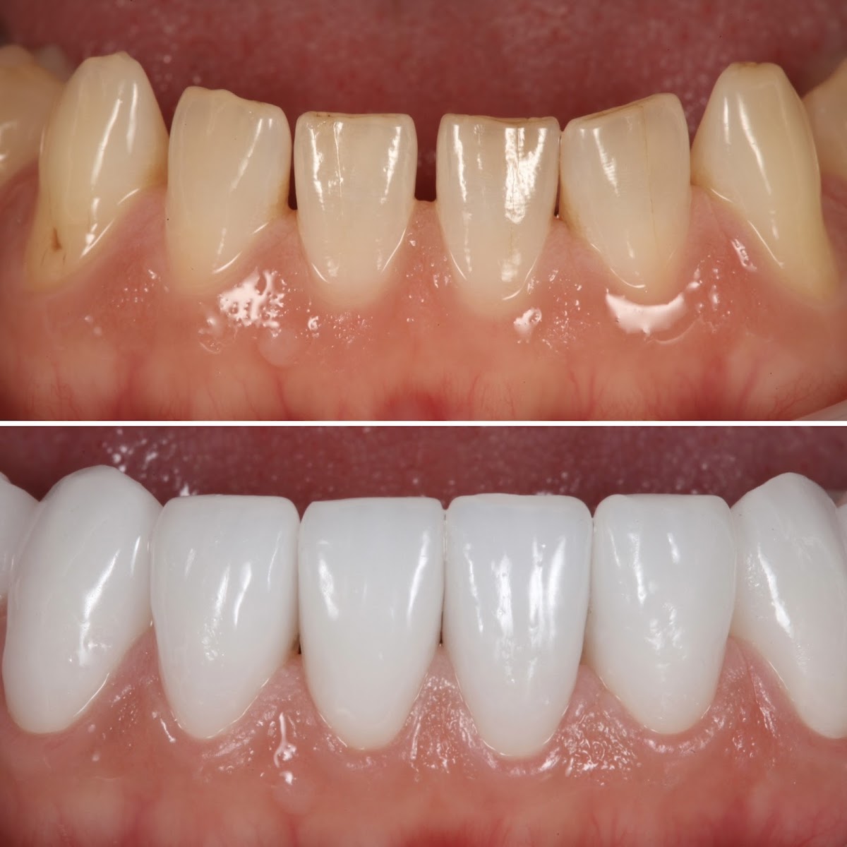 Strupp/brumm Seminars - Continuing Education Seminars for Dentists - Clearwater Fl - San Diego Ca photo 2