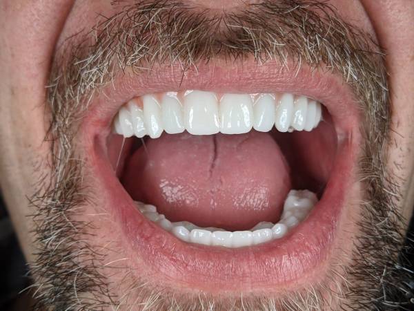 New Life Dental Implant Center photo 1