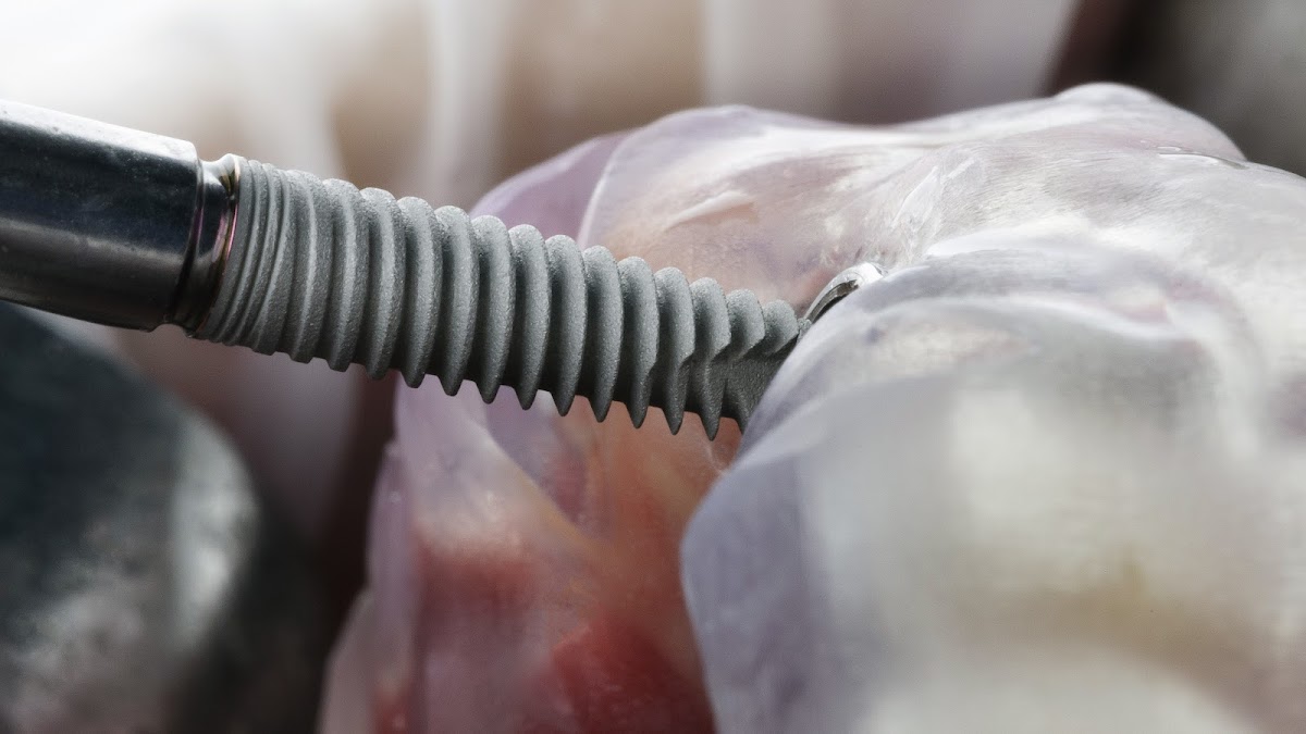New Life Dental Implant Center photo 2