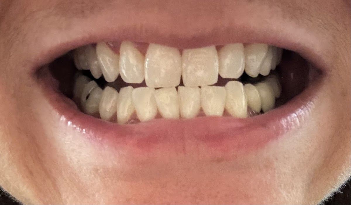 Konikoff Family Dentistry - Brambleton photo 3