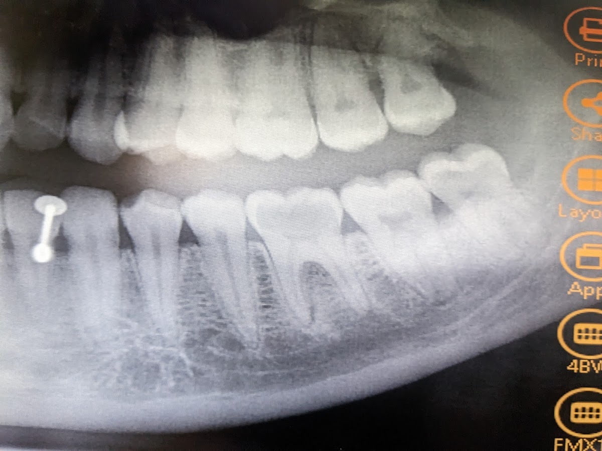 Hickory Hills Dental Care photo 5