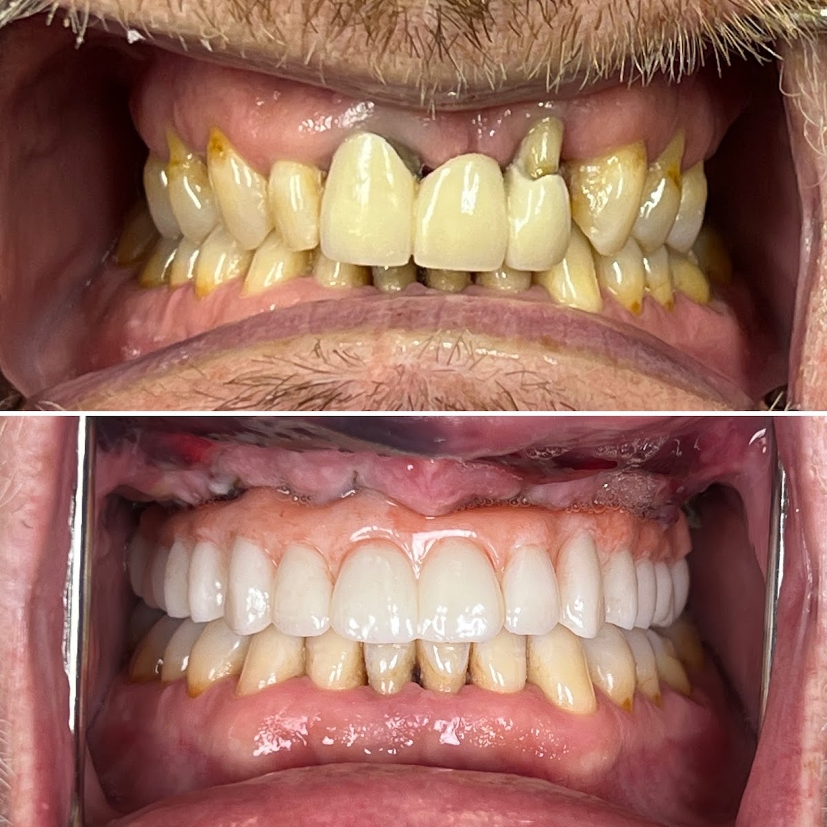 Advanced Dental & Implant Center photo 2