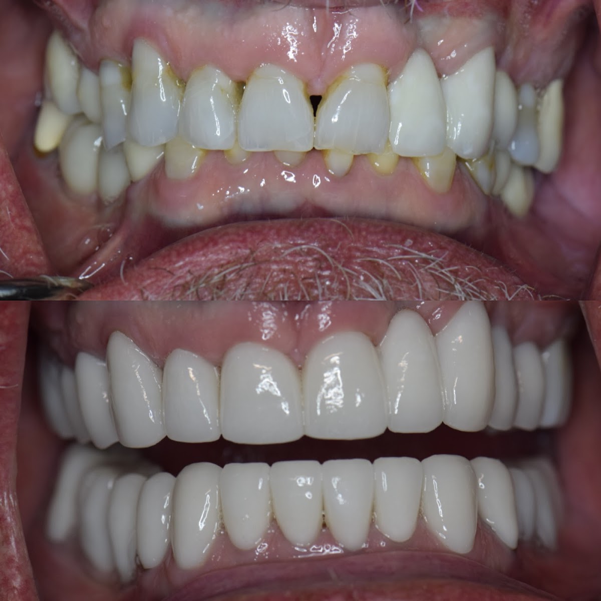 Elite Dentistry of Simi Valley - Simi Valley Dentist photo 2