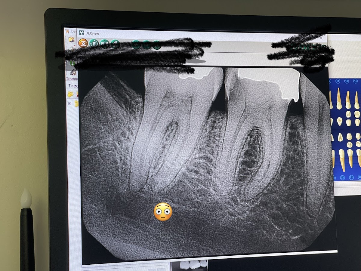 Aspen Dental - North Miami Beach photo 5