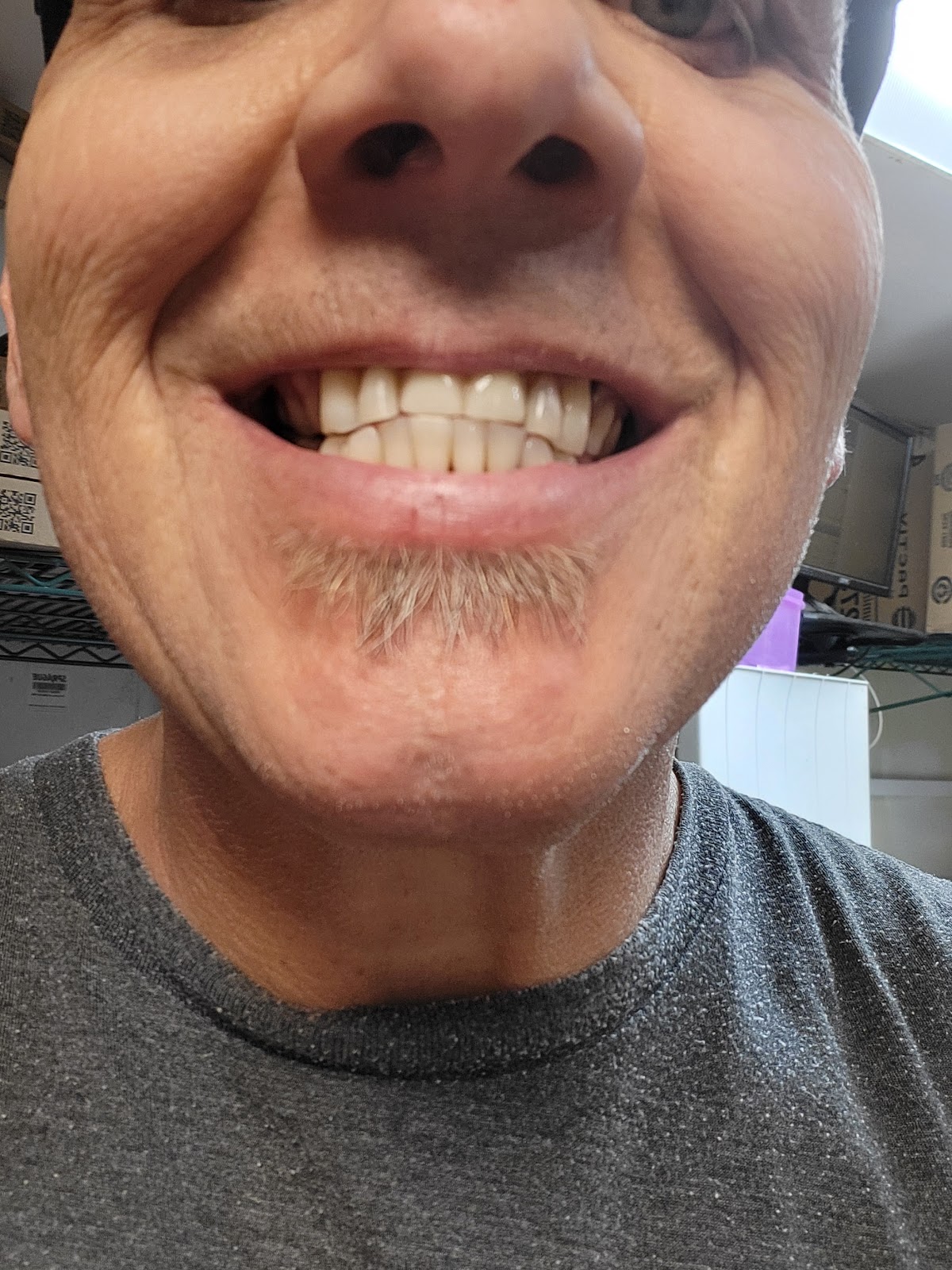 Union Family Dental Clinic photo 2