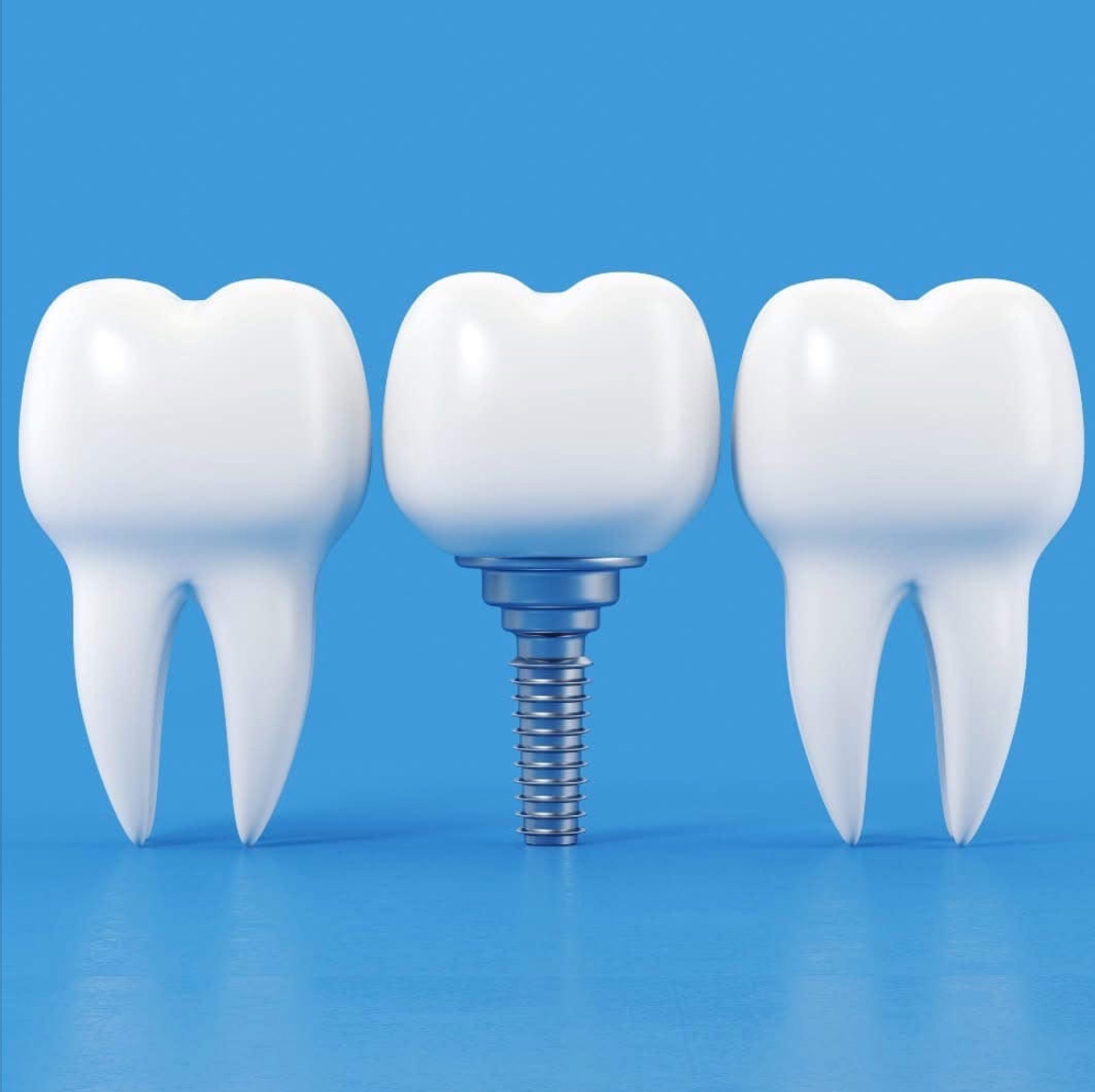 International Dental Center photo 3