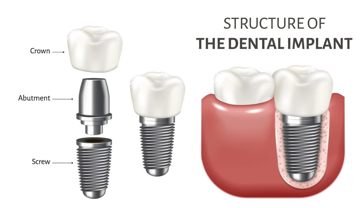 International Dental Center photo 6