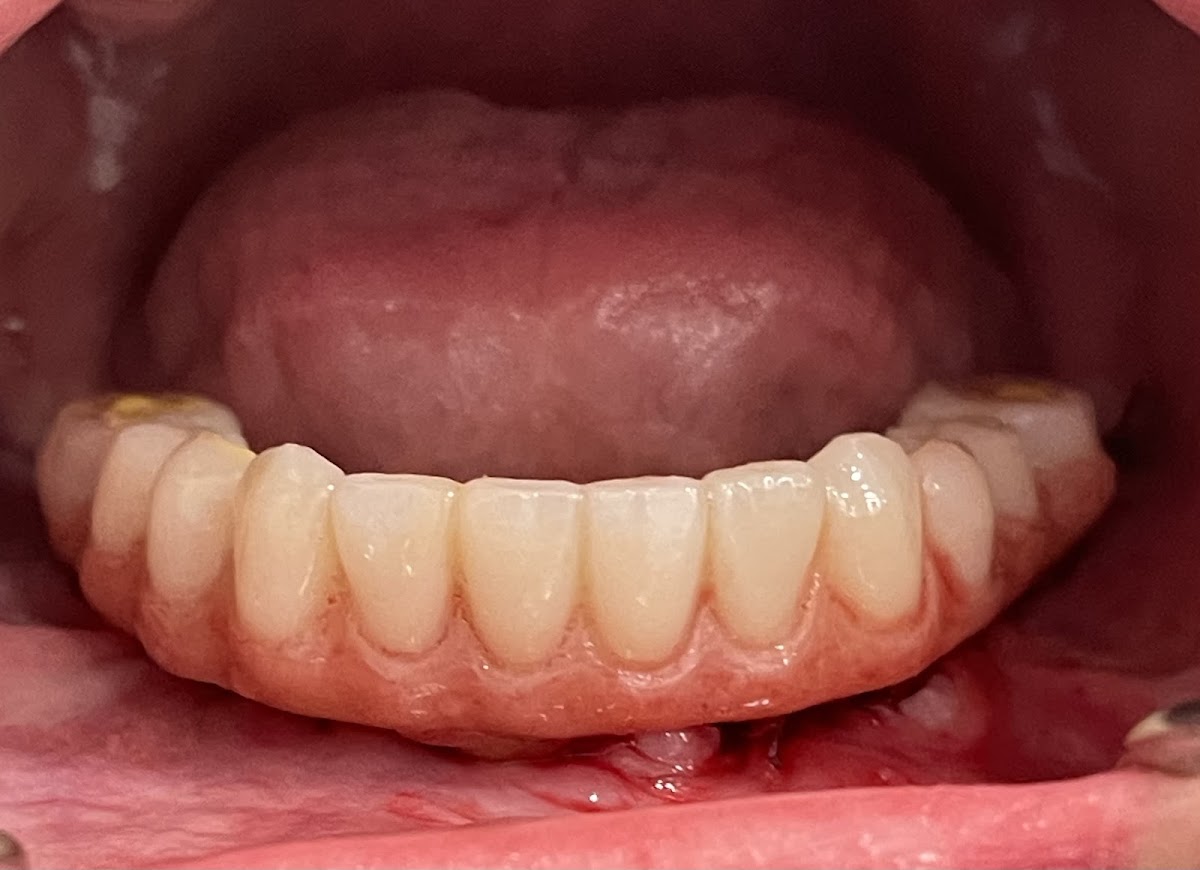 Pic Dental photo 4