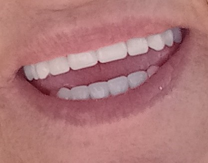 Access Dental, Dentures & Implants photo 2