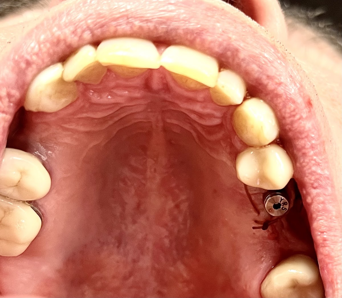 Mid-state Oral Surgery & Implant Center photo 2
