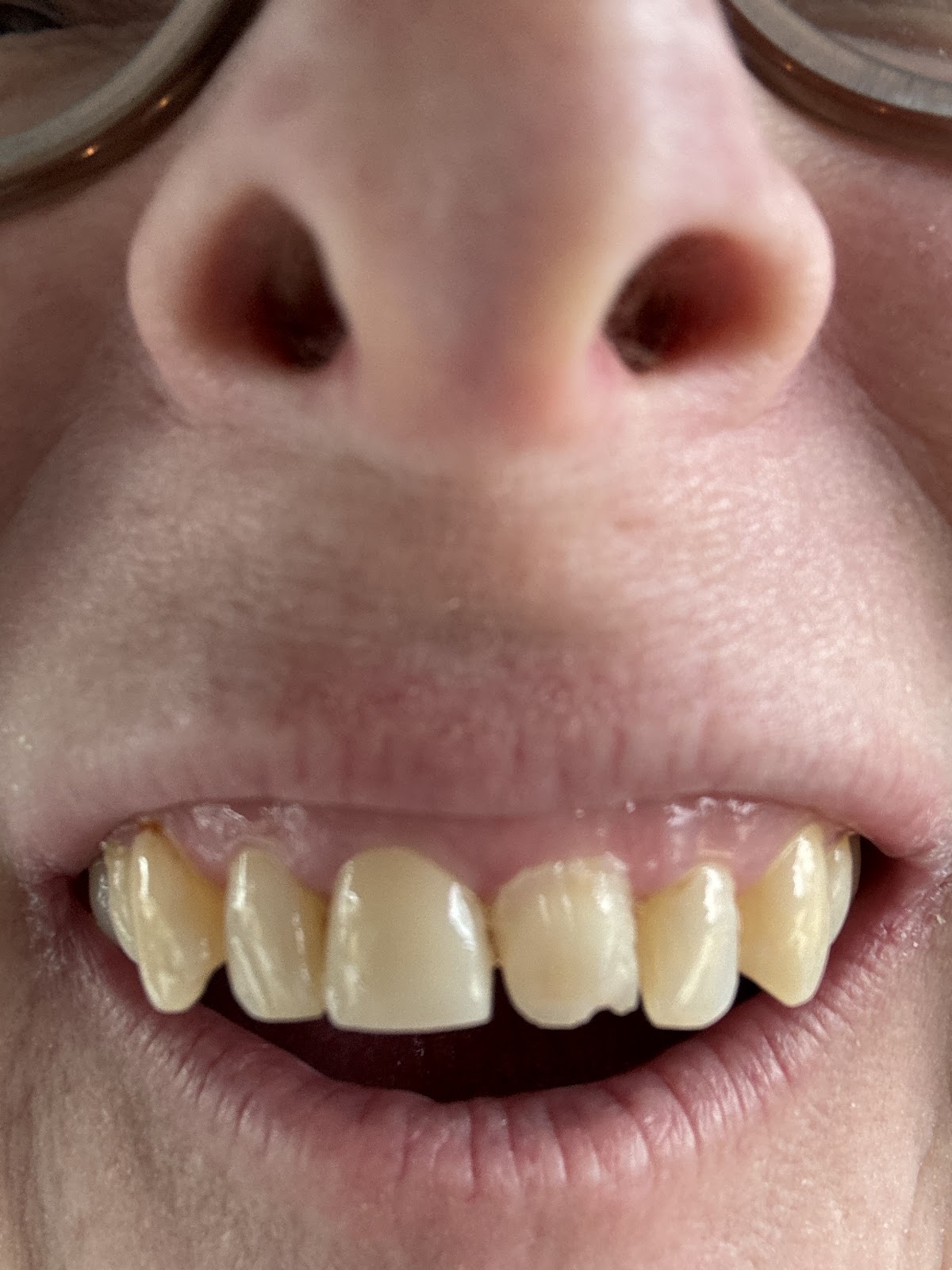 Aspen Dental - Olathe photo 5
