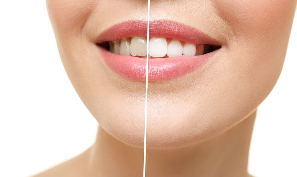 Alton Implant Center & Family Dentistry Of Irvine Oc photo 6