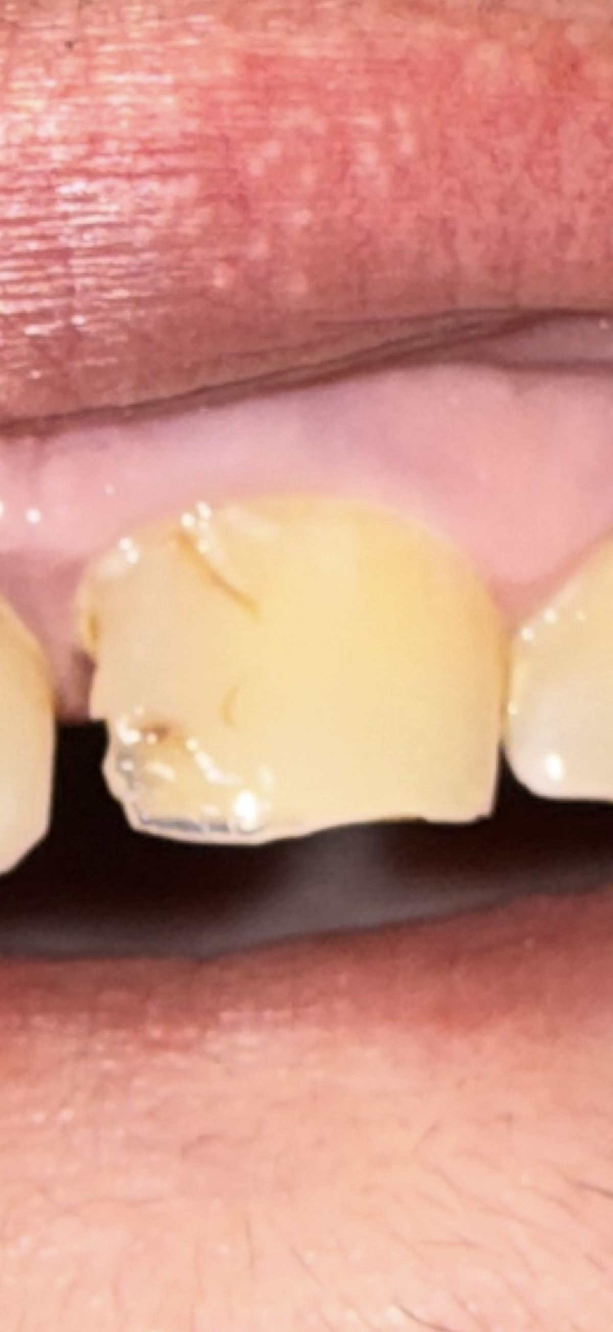North Broad Family Dental & Orthodontics photo 5