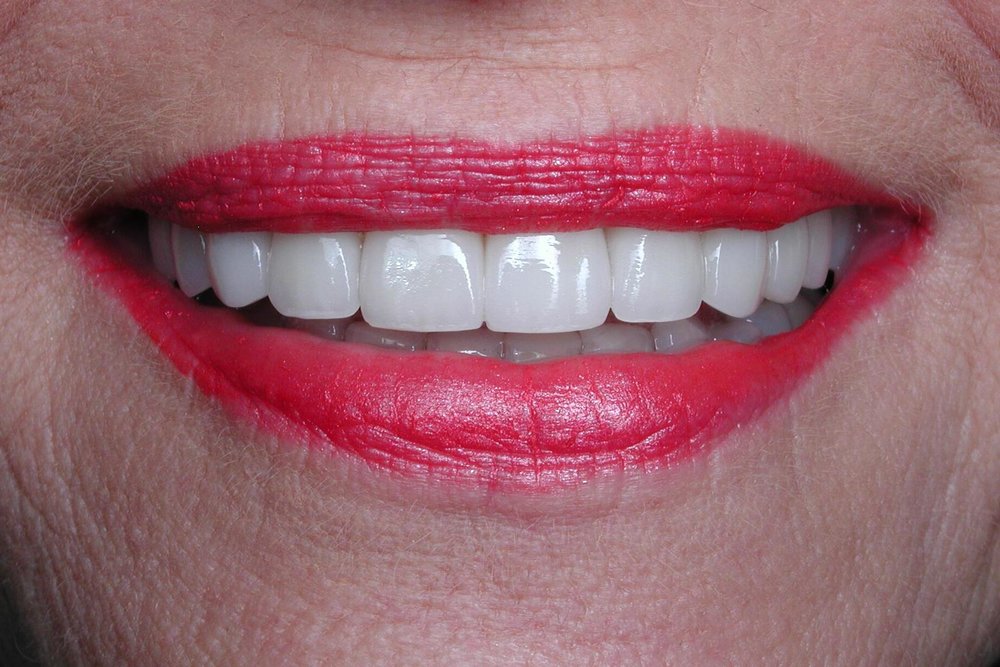 Adobe Dental Design of Sedona photo 1