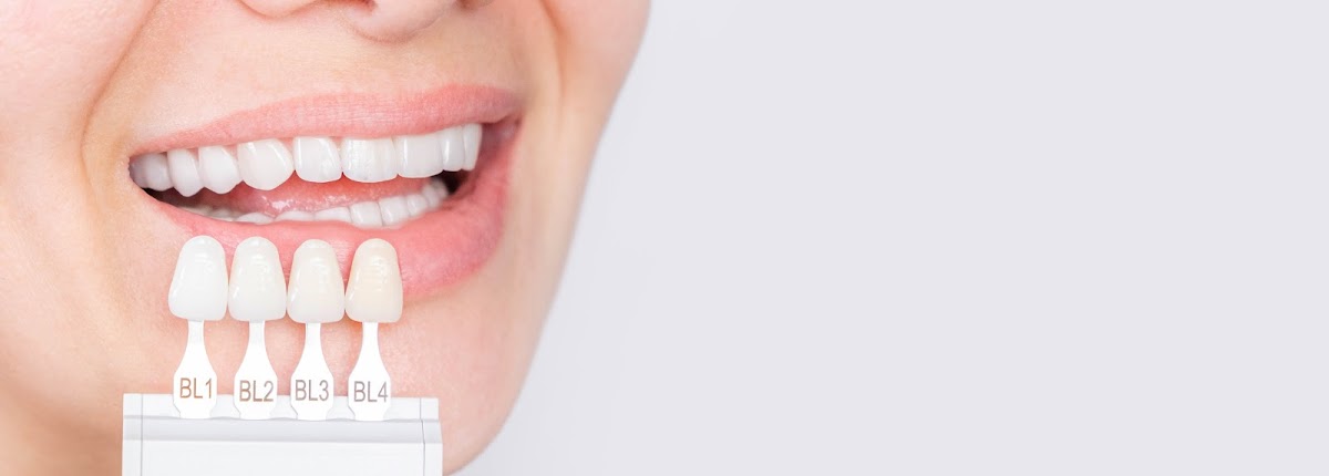 Varanismile: Antoine Varani, DDS photo 3