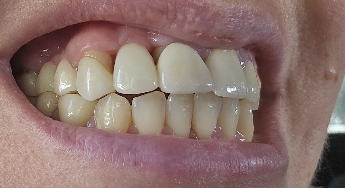 Aspen Dental - Florida City photo 5